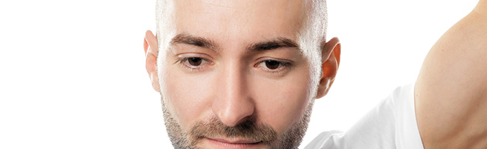 What Are the Advantages and Disadvantages of Hair Transplant?